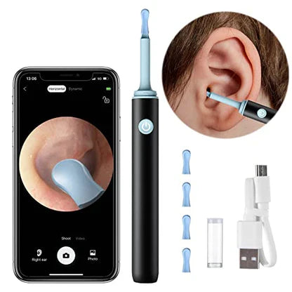 LUMARRO™   - PROFESSIONAL EAR WAX REMOVAL TOOL