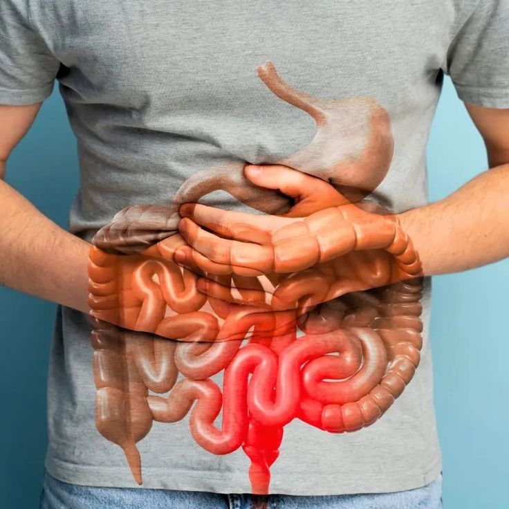 LUMARRO™  - GUT SUPPORT CAPSULE