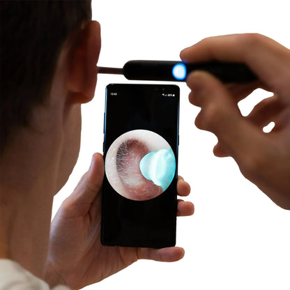 LUMARRO™   - PROFESSIONAL EAR WAX REMOVAL TOOL